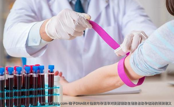 精子DNA碎片指数与存活率对美国辅助生殖患者助孕结局的预测意义