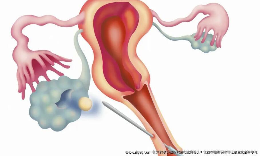 北京有多少家医院三代试管婴儿？北京有哪些医院可以做三代试管婴儿