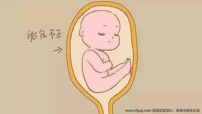 美国试管婴儿：智商与遗传之谜
