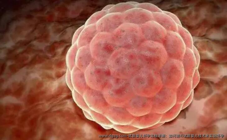 试管婴儿怀孕流程详解：如何进行试管婴儿技术来实现怀孕