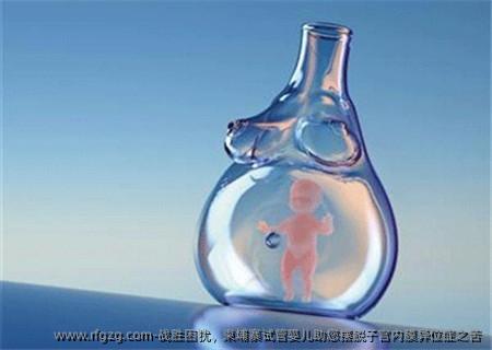 战胜困扰，柬埔寨试管婴儿助您摆脱子宫内膜异位症之苦