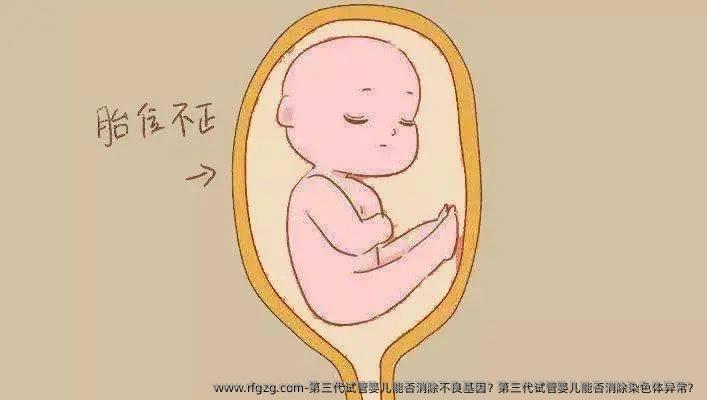 第三代试管婴儿能否消除不良基因？第三代试管婴儿能否消除染色体异常？