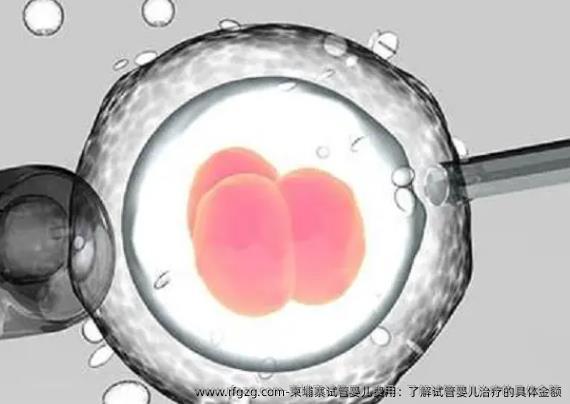 柬埔寨试管婴儿费用：了解试管婴儿治疗的具体金额