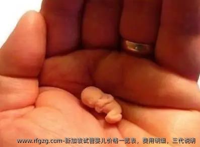 新加坡试管婴儿价格一览表，费用明细，三代说明