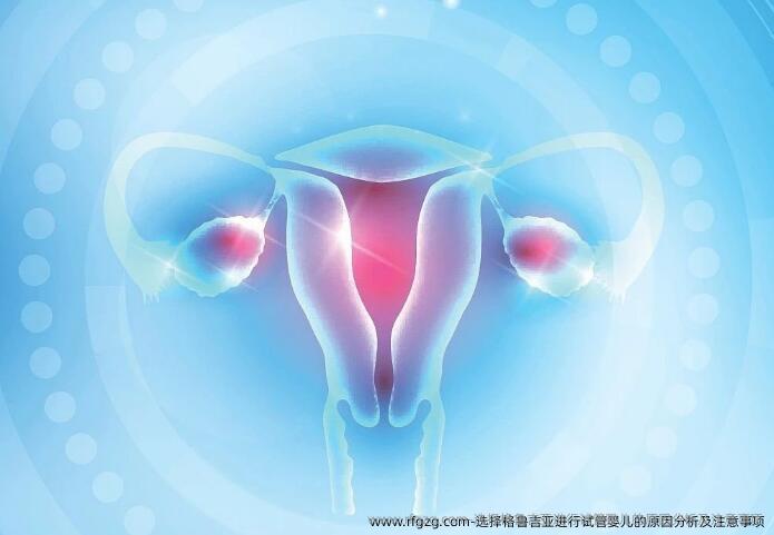 选择格鲁吉亚进行试管婴儿的原因分析及注意事项