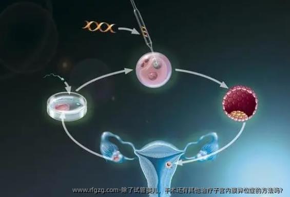 除了试管婴儿，手术还有其他治疗子宫内膜异位症的方法吗？