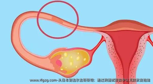 从日本到吉尔吉斯斯坦：通过跨国试管助孕让无数家庭抱娃