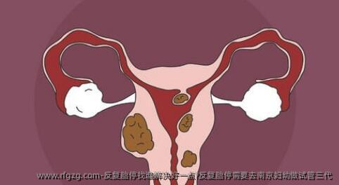 反复胎停找谁解决好一点?反复胎停需要去南京妇幼做试管三代