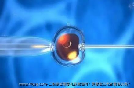 二胎做试管婴儿效果如何？需要做三代试管婴儿吗？
