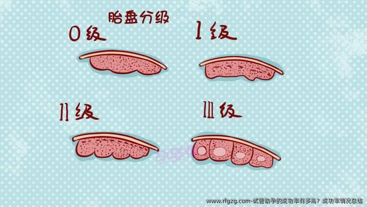 试管助孕的成功率有多高？成功率情况总结