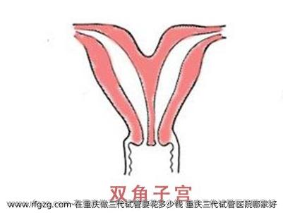 在重庆做三代试管要花多少钱 重庆三代试管医院哪家好