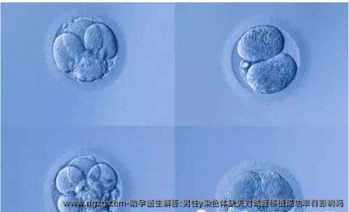 助孕医生解答:男性y染色体缺失对试管移植成功率有影响吗