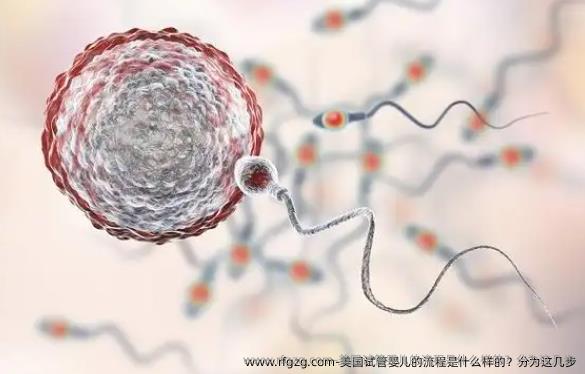 美国试管婴儿的流程是什么样的？分为这几步