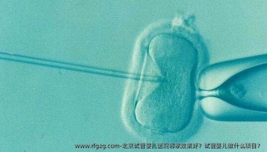 北京试管婴儿医院哪家效果好？试管婴儿做什么项目？