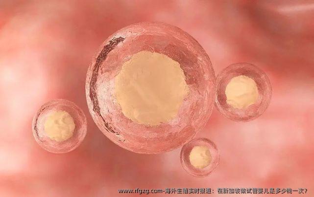 海外生殖实时报道：在新加坡做试管婴儿是多少钱一次？