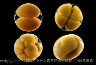 试管婴儿做什么项目好 做试管婴儿的过程累吗