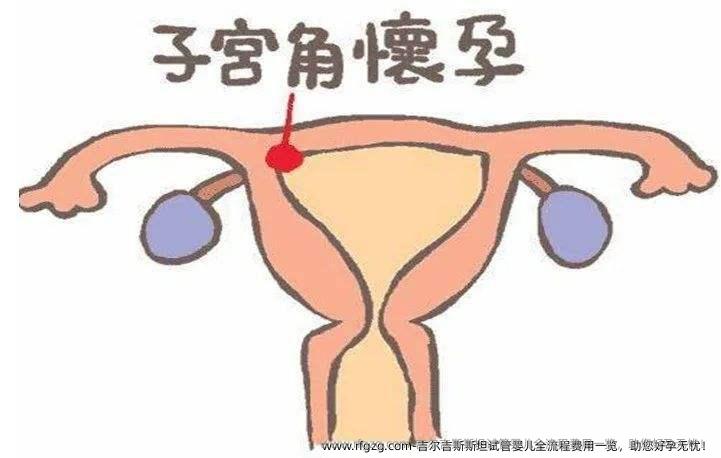 吉尔吉斯斯坦试管婴儿全流程费用一览，助您好孕无忧！