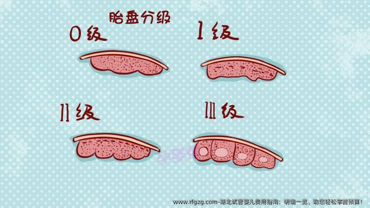 湖北试管婴儿费用指南：明细一览，助您轻松掌握预算！