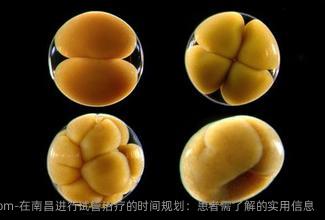 在南昌进行试管治疗的时间规划：患者需了解的实用信息