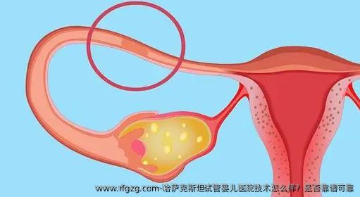 哈萨克斯坦试管婴儿医院技术怎么样？是否靠谱可靠