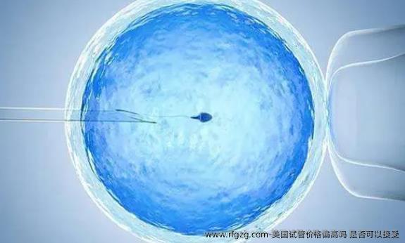 美国试管价格偏高吗?是否可以接受
