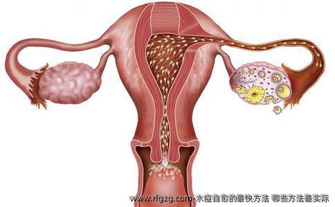 水痘自愈的最快方法 哪些方法最实际
