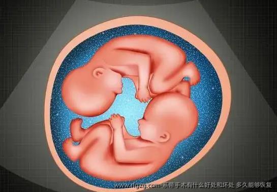 系带手术有什么好处和坏处，多久能够恢复