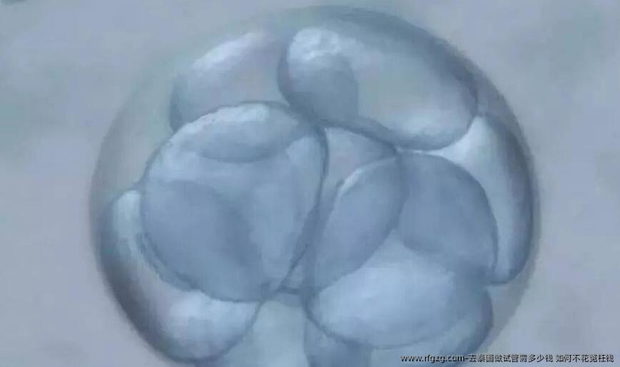 去泰国做试管需多少钱?如何不花冤枉钱?