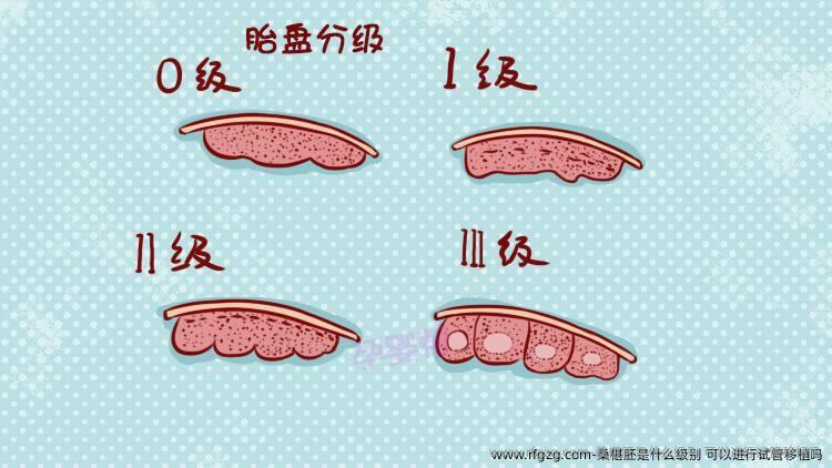 桑椹胚是什么级别？可以进行试管移植吗？