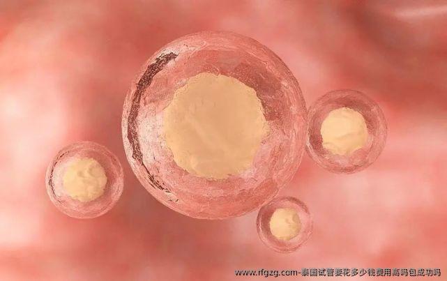 泰国试管要花多少钱费用高吗高成功吗