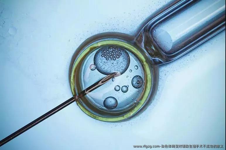 染色体畸变对辅助生殖手术不成功的意义