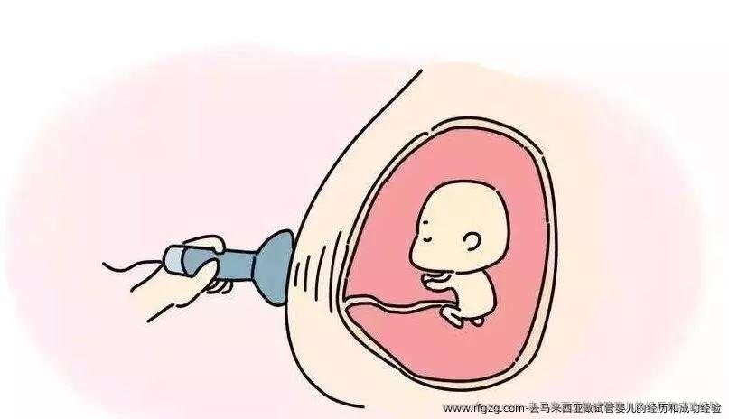 去马来西亚做试管婴儿的经历和成功经验