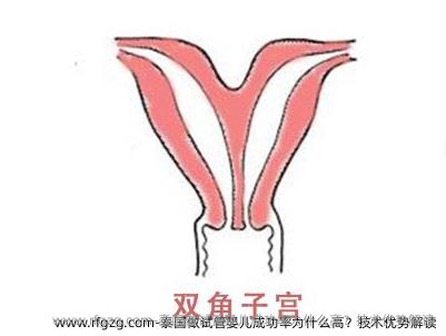 泰国做试管婴儿成功率为什么高？技术优势解读
