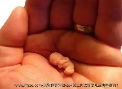 染色体异常做福州第三代试管婴儿成功率高吗？