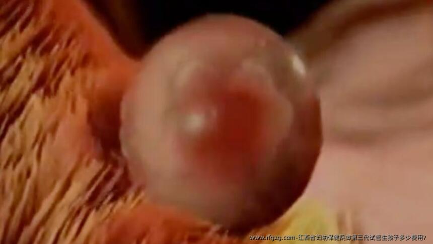江西省妇幼保健院做第三代试管生孩子多少费用？