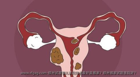 郑州试管婴儿医院排名较好是哪家？郑州哪家试管医院好？