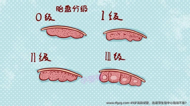 49岁高龄试管，选诺芽生殖中心抱娃不难？