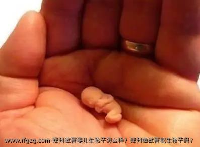 郑州试管婴儿生孩子怎么样？郑州做试管能生孩子吗？