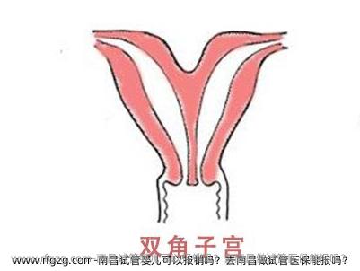 南昌试管婴儿可以报销吗？去南昌做试管医保能报吗？