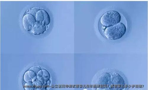 公立医院申请试管婴儿有年龄限制吗？试管婴儿多少岁能做？