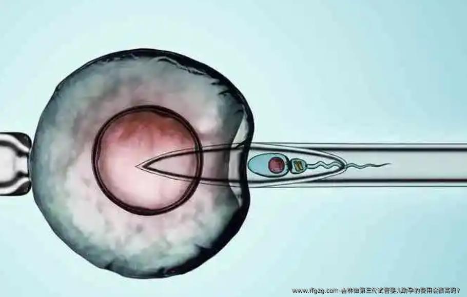 吉林做第三代试管婴儿助孕的费用会很高吗？
