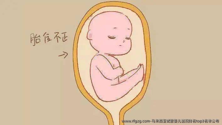 马来西亚试管婴儿医院排名top3名单公布