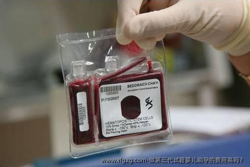 做第三代试管婴儿助孕的费用高吗？