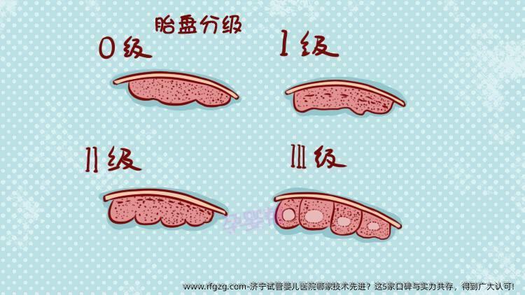 济宁试管婴儿医院哪家技术先进？这5家口碑与实力共存，得到广大认可！