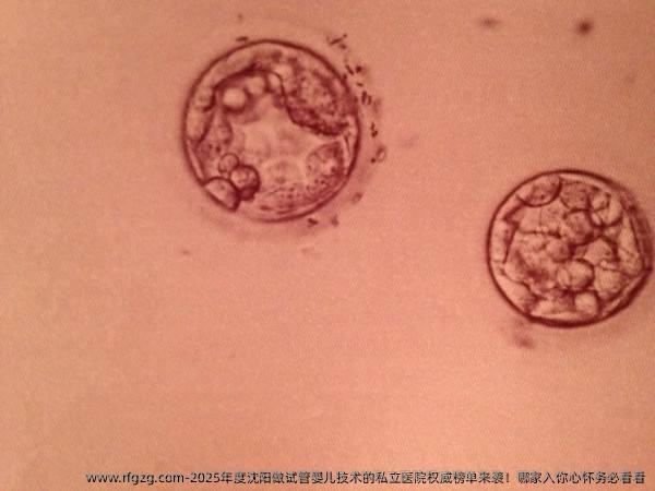 2025年度沈阳做试管婴儿技术的私立医院优秀榜单来袭！哪家入你心怀务必看看