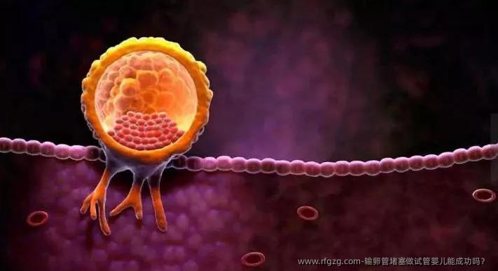 输卵管堵塞做试管婴儿能成功吗？
