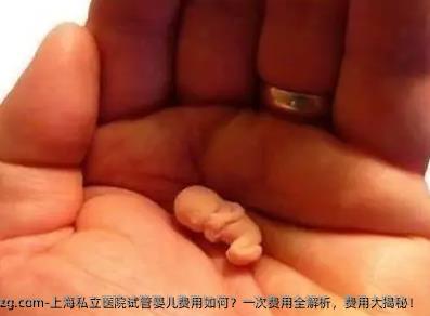 上海私立医院试管婴儿费用如何？一次费用全解析，费用大揭秘！