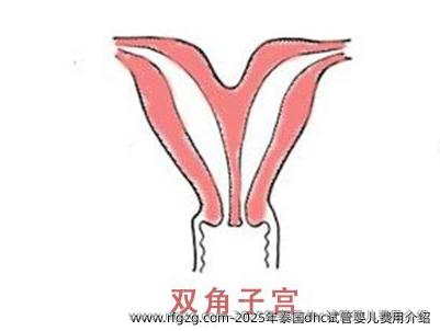 2025年泰国dhc试管婴儿费用介绍