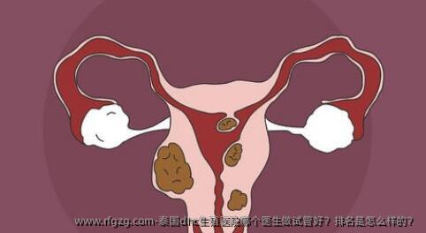 泰国dhc生殖医院哪个医生做试管好？排名是怎么样的？
