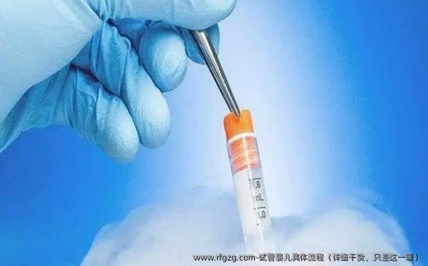 试管婴儿具体流程（详细干货，只差这一篇）
